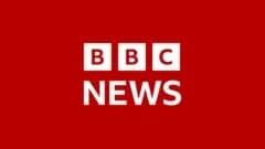 "أصبحت أشبه نفسي" ما قصة أول زراعة وجه من متبرعة ميتة؟