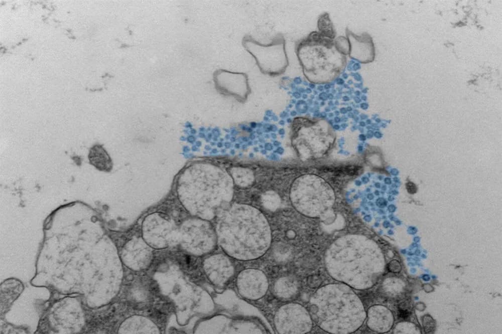 لماذا يؤثر نفس الفيروس على بعض الأشخاص بشكل أكثر شدة من غيرهم؟ السر في دور الأنف