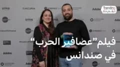 "أصبحت أشبه نفسي" ما قصة أول زراعة وجه من متبرعة ميتة؟